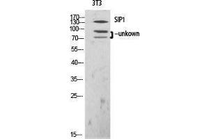 Western Blotting (WB) image for anti-Gem (Nuclear Organelle) Associated Protein 2 (GEMIN2) (N-Term) antibody (ABIN3177416) (SIP1 anticorps  (N-Term))