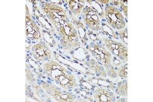 Immunohistochemistry of paraffin-embedded mouse kidney using AIP antibody. (AIP anticorps  (AA 1-330))