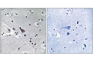 Immunohistochemistry analysis of paraffin-embedded human brain, using SLC6A16 Antibody. (SLC6A16 anticorps  (AA 233-282))