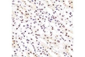 Immunohistochemistry of paraffin embedded rat kidney using GTF3C3 (ABIN7074039) at dilution of 1: 2500 (400x lens)