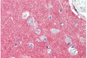 Human Brain, Cortex: Formalin-Fixed, Paraffin-Embedded (FFPE)