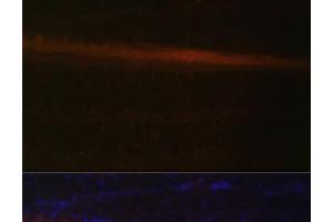 Immunofluorescence analysis of Rat retina using RDH5 Polyclonal Antibody at dilution of 1:100 (40x lens). (RDH5 anticorps)