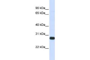 WB Suggested Anti-SPINT2 Antibody Titration:  0. (SPINT2 anticorps  (Middle Region))