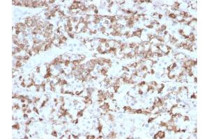Formalin-fixed, paraffin-embedded human Pituitary stained with Prolactin Mouse Monoclonal Antibody (PRL/2910). (Prolactin anticorps  (AA 63-201))