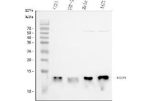 Western blot analysis of Beta 2 Microglobulin using anti-Beta 2 Microglobulin antibody (ABIN5518810).