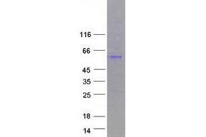 Validation with Western Blot