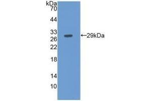 Detection of Recombinant FBLN3, Human using Monoclonal Antibody to Fibulin 3 (FBLN3)