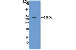 Detection of Recombinant FBLN3, Human using Monoclonal Antibody to Fibulin 3 (FBLN3) (FBLN3 anticorps  (AA 258-493))