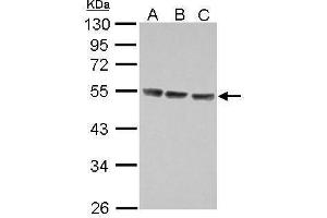 WB Image Sample (30 ug of whole cell lysate) A: Jurkat B: Raji C: K562 10% SDS PAGE antibody diluted at 1:5000 (IL13 Receptor alpha 1 anticorps)