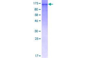 Image no. 1 for Nuclear Factor of kappa Light Polypeptide Gene Enhancer in B-Cells 1 (NFKB1) (AA 1-969) protein (GST tag) (ABIN1312483)