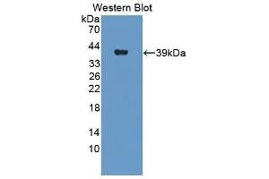 Western Blotting (WB) image for anti-Insulin Receptor (INSR) (AA 1027-1364) antibody (ABIN1859482) (Insulin Receptor anticorps  (AA 1027-1364))