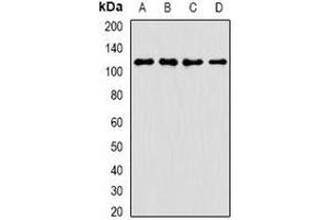 Western blot analysis of ANR52 expression in A549 (A), K562 (B), mouse brain (C), rat liver (D) whole cell lysates. (ANKRD52 anticorps)
