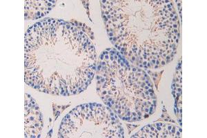 IHC-P analysis of testis tissue, with DAB staining. (LAMa4 anticorps  (AA 457-630))