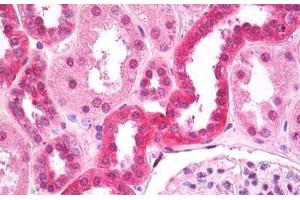 Anti-FIH / CASR antibody IHC staining of human kidney, tubules. (CASR anticorps  (AA 214-235))