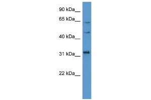 WB Suggested Anti-MKNK1 Antibody Titration: 0. (MKNK1 anticorps  (C-Term))
