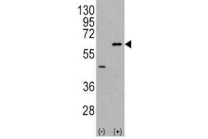 Western blot analysis of AKT3 antibody and 293 cell lysate (2 ug/lane) either nontransfected (Lane 1) or transiently transfected with the AKT3 gene (2).