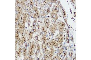 Immunohistochemistry of paraffin-embedded Rat cartilage using Aggrecan Rabbit pAb (ABIN6127417, ABIN6136406, ABIN6136408 and ABIN6224631) at dilution of 1:50 (40x lens).