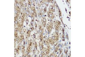 Immunohistochemistry of paraffin-embedded Rat cartilage using Aggrecan Rabbit pAb (ABIN6127417, ABIN6136406, ABIN6136408 and ABIN6224631) at dilution of 1:50 (40x lens). (Aggrecan anticorps  (AA 20-280))
