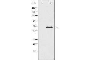 Western blot analysis of PTP1B expression in UV treated COS7 whole cell lysates,The lane on the left is treated with the antigen-specific peptide.