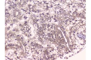 IHC analysis of TNFRSF11B using anti-TNFRSF11B antibody (ABIN7600875).
