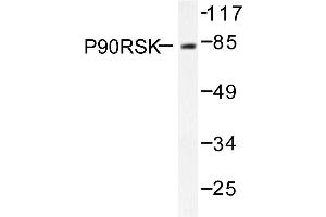 Image no. 1 for anti-Ribosomal Protein S6 Kinase, 90kDa, Polypeptide 1 (RPS6KA1) antibody (ABIN271934) (RPS6KA1 anticorps)