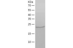 Western Blotting (WB) image for Glutathione S-Transferase mu 1 (GSTM1) (AA 1-218) protein (His-IF2DI Tag) (ABIN7123140)