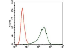 Immunohistochemical analysis of paraffin-embedded ovarian cancer tissues using SRY antibody with DAB staining. (SRY anticorps  (AA 1-204))