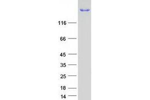 Validation with Western Blot