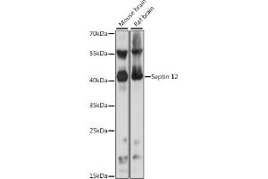 Western blot analysis of extracts of various cell lines, using Septin 12 antibody (ABIN7265307) at 1:1000 dilution.