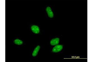 Immunofluorescence of purified MaxPab antibody to ERCC8 on HeLa cell. (ERCC8 anticorps  (AA 1-396))