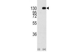 Western blot analysis of FGFR antibody and 293 cell lysate (2 ug/lane) either nontransfected (Lane 1) or transiently transfected with the FGFR1 gene (2).