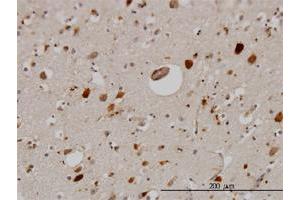 Immunoperoxidase of monoclonal antibody to PTN on formalin-fixed paraffin-embedded human cerebral cortex. (Pleiotrophin anticorps  (AA 45-154))