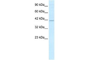 RFP2 antibody (20R-1084) used at 2. (TRIM13 anticorps  (Middle Region))
