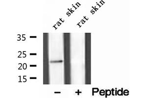 Western blot analysis of extracts of rat skin tissue, using Dermatopontin antibody. (Dermatopontin anticorps  (Internal Region))
