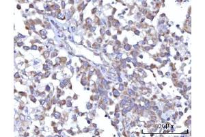 IHC analysis of C18orf22/RBFA using anti-C18orf22/RBFA antibody (ABIN7600106). (RBFA anticorps  (AA 15-319))