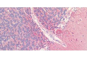 Immunohistochemistry of paraffin-embedded Human cerebellum using HTR1A Polyclonal Antibody at dilution of 1:60. (Serotonin Receptor 1A anticorps)