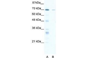 WB Suggested Anti-ZNF37A Antibody Titration:  1. (ZNF37A anticorps  (Middle Region))
