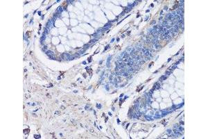 Immunohistochemistry of paraffin-embedded Human colon using NLRC4 Polyclonal Antibody at dilution of 1:100 (40x lens). (NLRC4 anticorps)