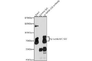 Immunoprecipitation analysis of 200 μg extracts of HeLa cells, using 3 μg Phospho-Lamin A/C-S22 pAb (ABIN6135255, ABIN6136134, ABIN6136135 and ABIN6225675).