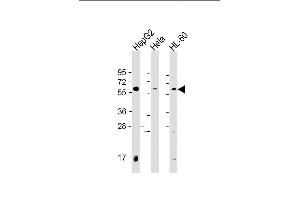 All lanes : Anti-PI4K2A Antibody (C-term) at 1:2000 dilution Lane 1: HepG2 whole cell lysate Lane 2: Hela whole cell lysate Lane 3: HL-60 whole cell lysate Lysates/proteins at 20 μg per lane. (PI4K2A anticorps  (C-Term))