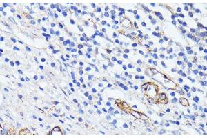 Immunohistochemistry of paraffin-embedded Human appendix using MADCAM1 Polyclonal Antibody at dilution of 1:100 (40x lens). (MADCAM1 anticorps)