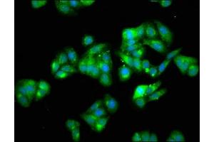 Immunofluorescence staining of HepG2 cells with ABIN7151663 at 1:66, counter-stained with DAPI.