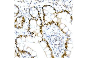 Immunohistochemistry of paraffin-embedded human small intestine using HNF-4-alpha Rabbit mAb (ABIN7267621) at dilution of 1:150 (40x lens). (HNF4A anticorps)