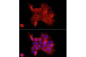Immunofluorescence analysis of  cells using CDH3 Rabbit pAb (ABIN7269142) at dilution of 1:100 (40x lens).