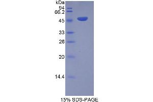 SDS-PAGE (SDS) image for Inducible T-Cell Co-Stimulator (ICOS) (AA 31-190) protein (His tag,GST tag) (ABIN1878967)