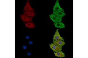 ABIN7095808 and ABIN7099870 staining HepG2 cells by IF/ICC.