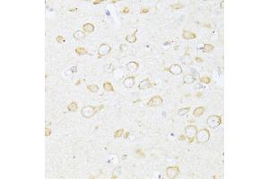Immunohistochemistry of paraffin-embedded rat brain using SQSTM1 antibody (ABIN2737581) at dilution of 1:100 (40x lens). (SQSTM1 anticorps)