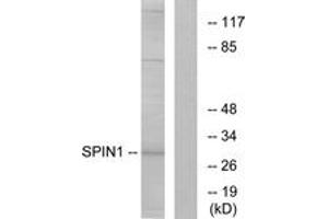Western blot analysis of extracts from HeLa cells, using SPIN1 Antibody.