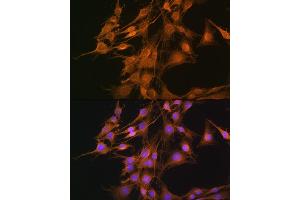 Immunofluorescence analysis of C6 cells using ELOVL4 Rabbit pAb (ABIN1679709, ABIN3017923, ABIN3017924 and ABIN6220305) at dilution of 1:100.