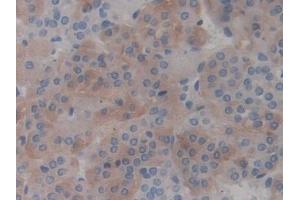 Detection of RAGE in Rat Adrenal gland Tissue using Polyclonal Antibody to Receptor For Advanced Glycation Endproducts (RAGE)